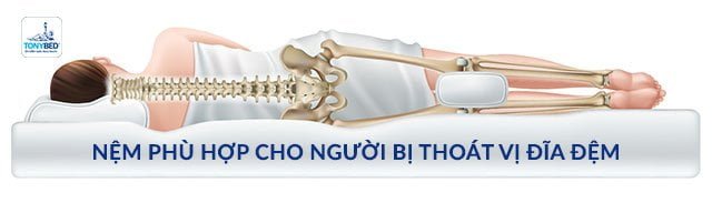 Bí quyết chọn nệm phù hợp hỗ trợ tốt nhất cho người bị thoát vị đĩa đệm