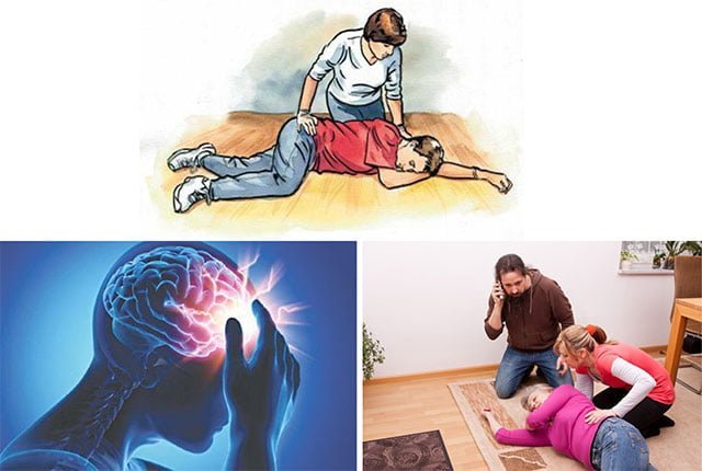 Tỉ lệ đột quỵ ở người bị thiếu ngủ dài hạn cao hơn so với người bình thường
