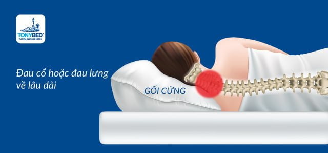 Gối cứng có thể gây đau cổ