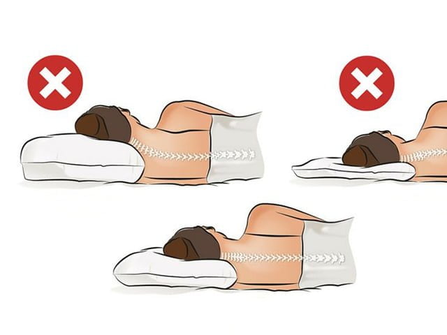 Lời khuyên của chuyên gia giúp bạn giảm đau mỏi vai gáy khi ngủ