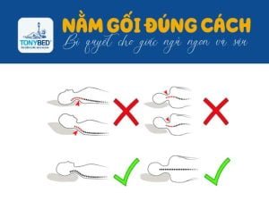 Nằm gối đúng cách bí quyết cho giấc ngủ ngon