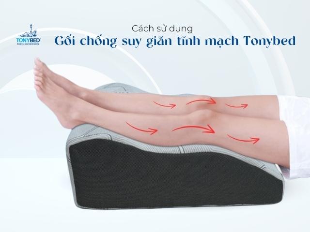 Cach su dung goi chong suy gian tinh mach